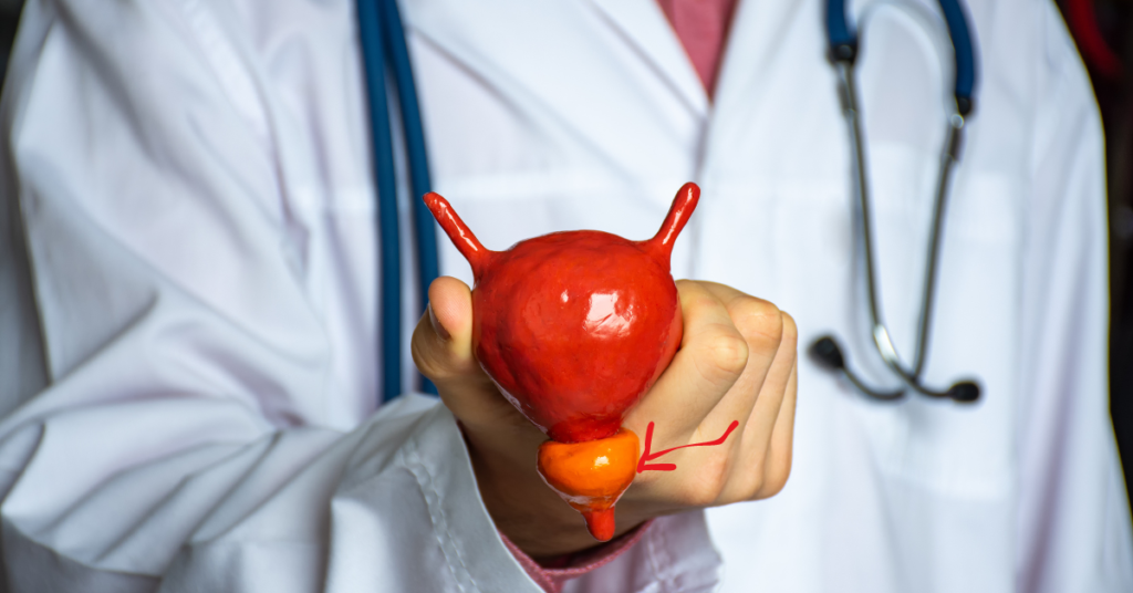 A doctor holding the model of a prostate.